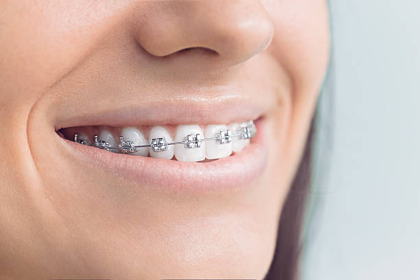Best Tooth Extraction  in Vineyard, UT